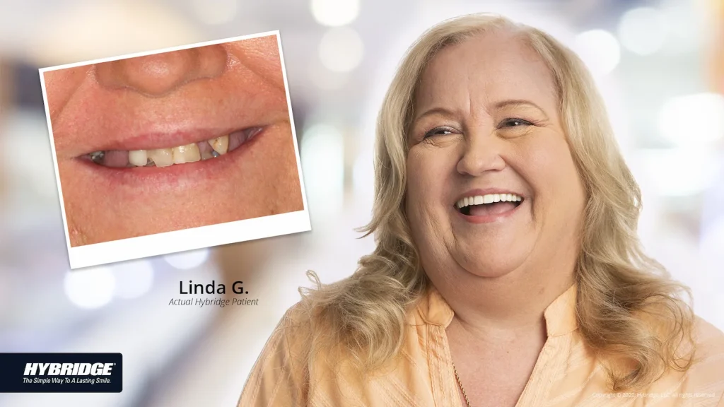Linda