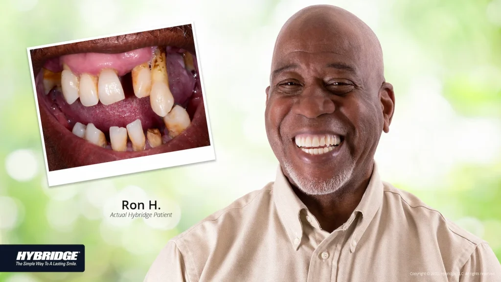 Ron