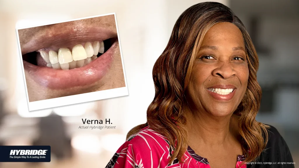 Verna