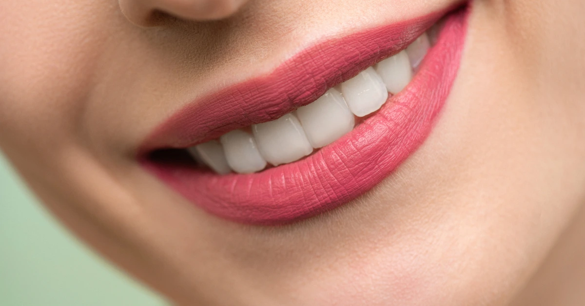 Smile after full-arch restoration