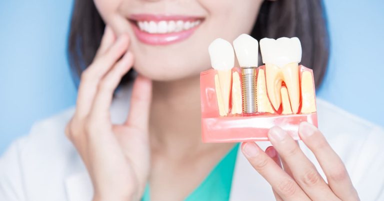 Dental implants in Henderson, NV