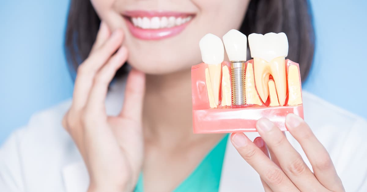 Single-Tooth Dental Implants: A Durable Solution for Tooth Replacement