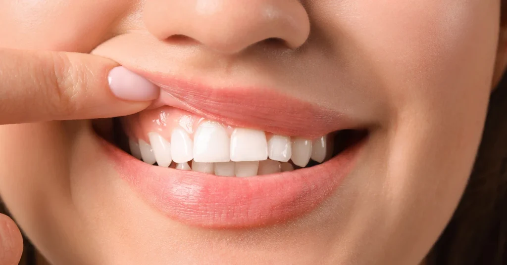 A person gently lifting their upper lip to reveal clean teeth and healthy pink gums, illustrating good oral hygiene and gum health.