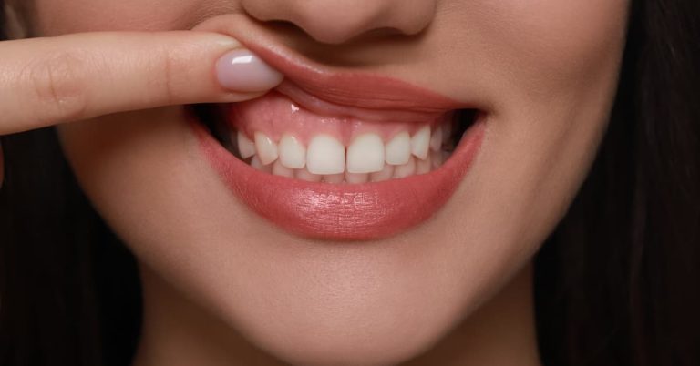 Gum graft solutions in Las Vegas