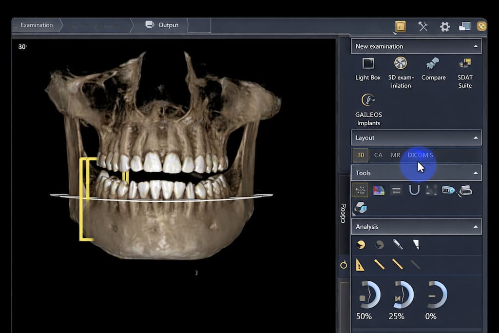 A CT scan for a dental implant treatment