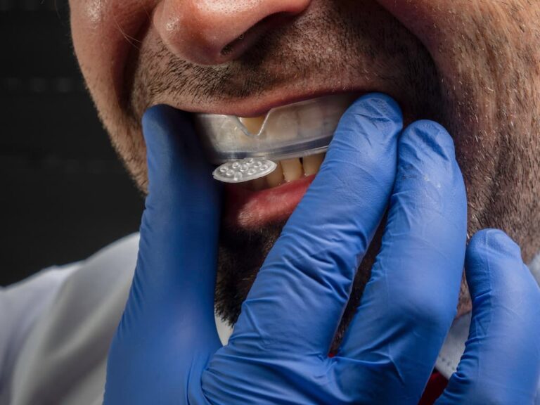 Dental Implants and Sports Protection: Essential Guide for Athletes and Active Adults