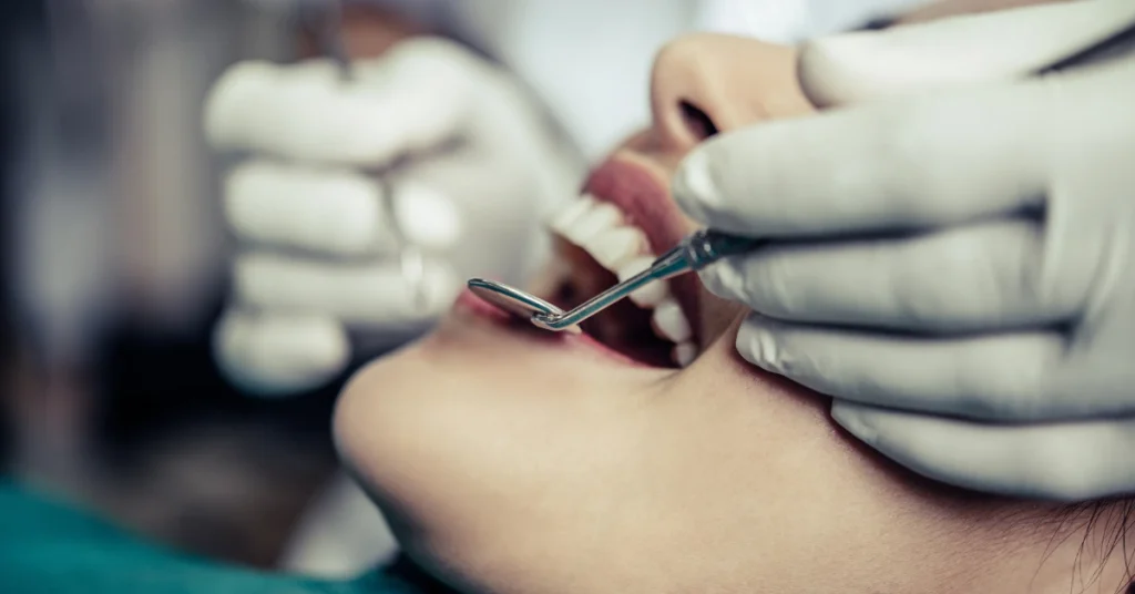 Full Arch Dental Implant Recovery Guide