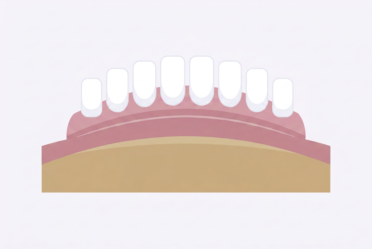 Denture resting on the gum ridge with no implants